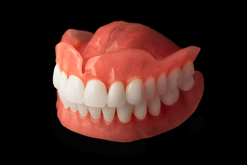 Denture example model