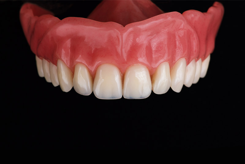 Denture example model