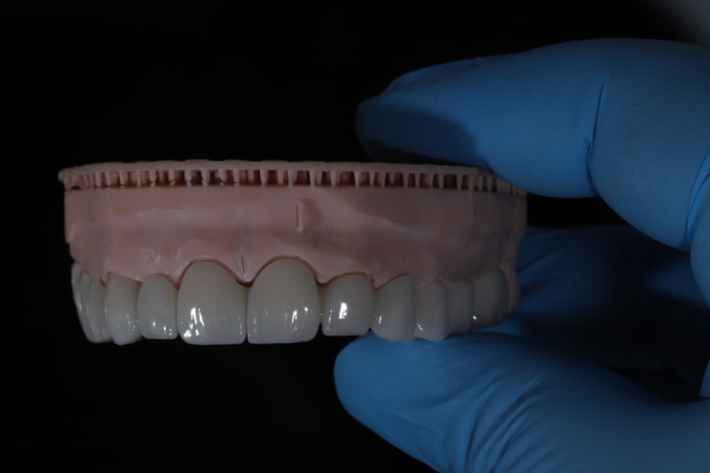 a full arch of teeth with a doctor holding it up
