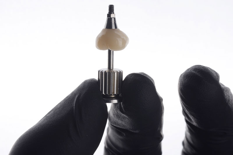 a single dental implant with a screw attached to the bottom
